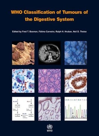 WHO Classification of Tumours of the Digestive System