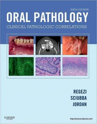 Oral pathology