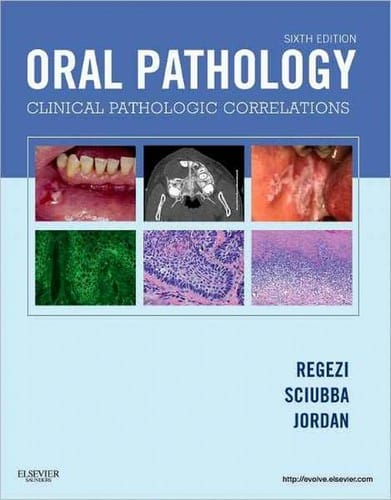 Oral pathology