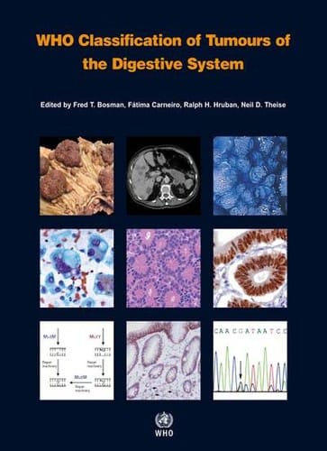 WHO Classification of Tumours of the Digestive System